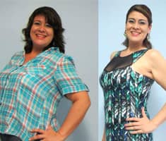 Slider image (2) Bypass Gastrico Merida